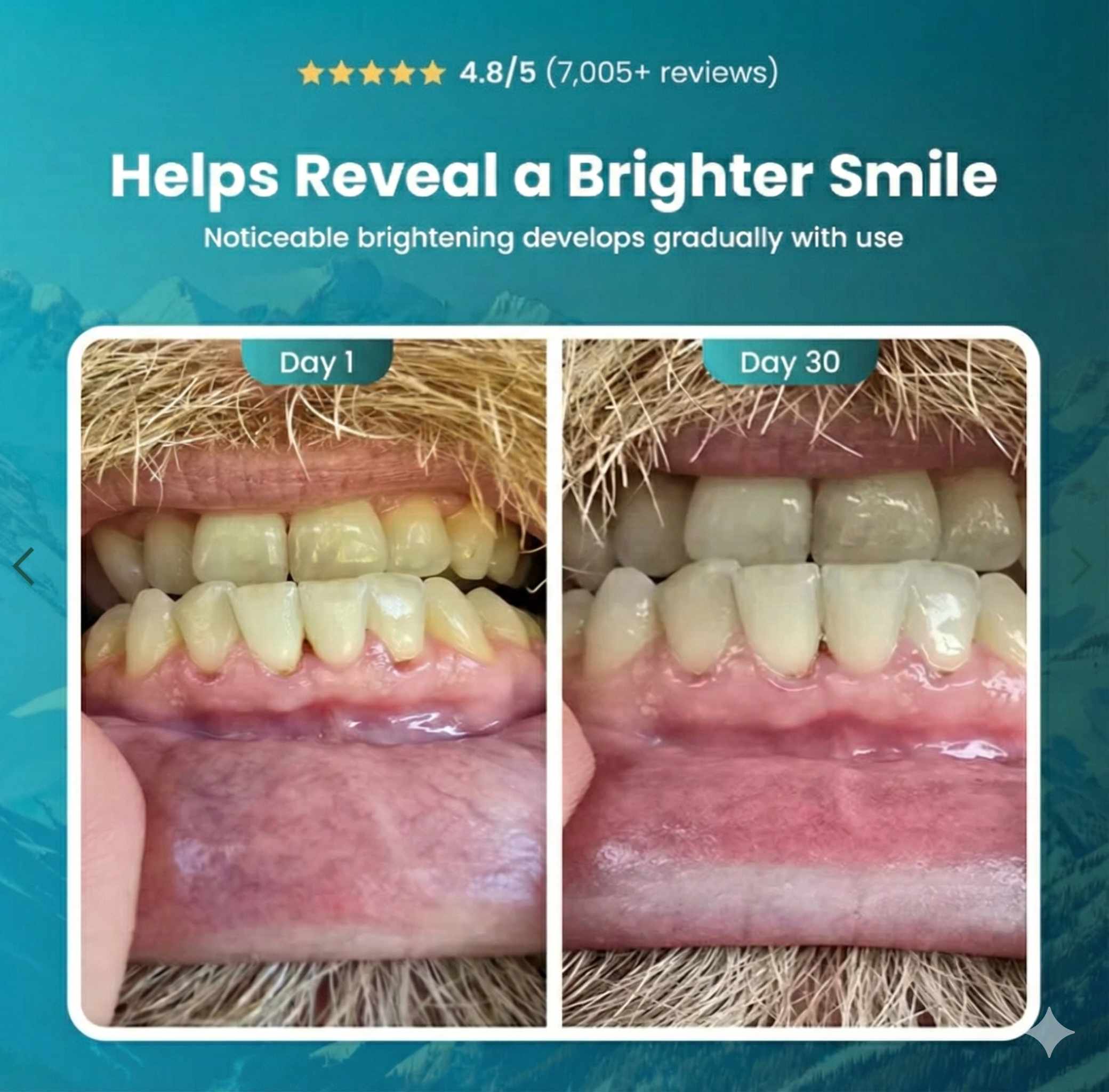 ORAVITE™ – Remineralizing Gum